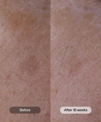 Advanced Pigment Corrector 1 oz