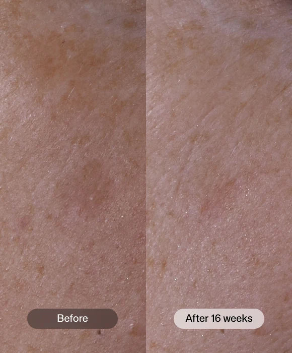 Advanced Pigment Corrector 1 oz