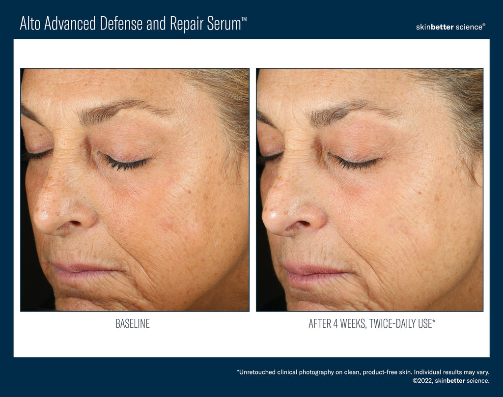 Alto Advanced Defense and Repair Serum