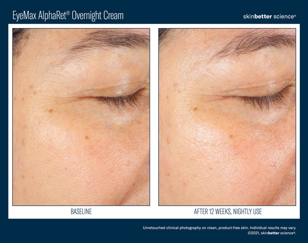 EyeMax AlphaRet Overnight Cream