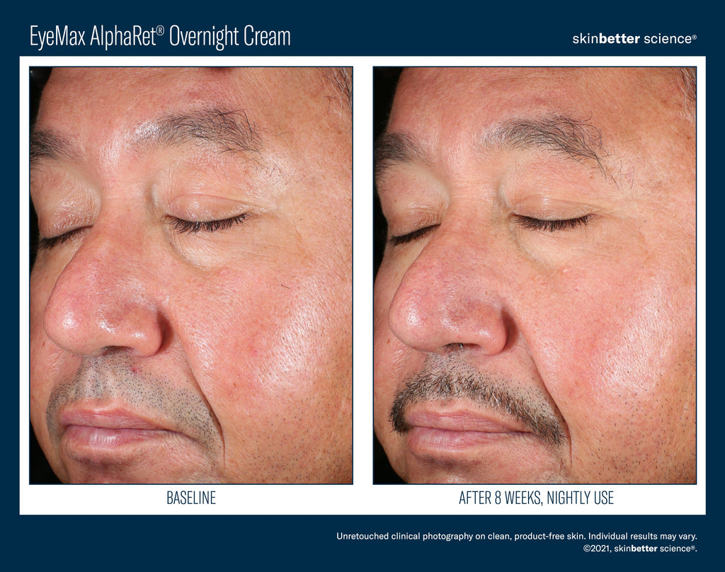 EyeMax AlphaRet Overnight Cream