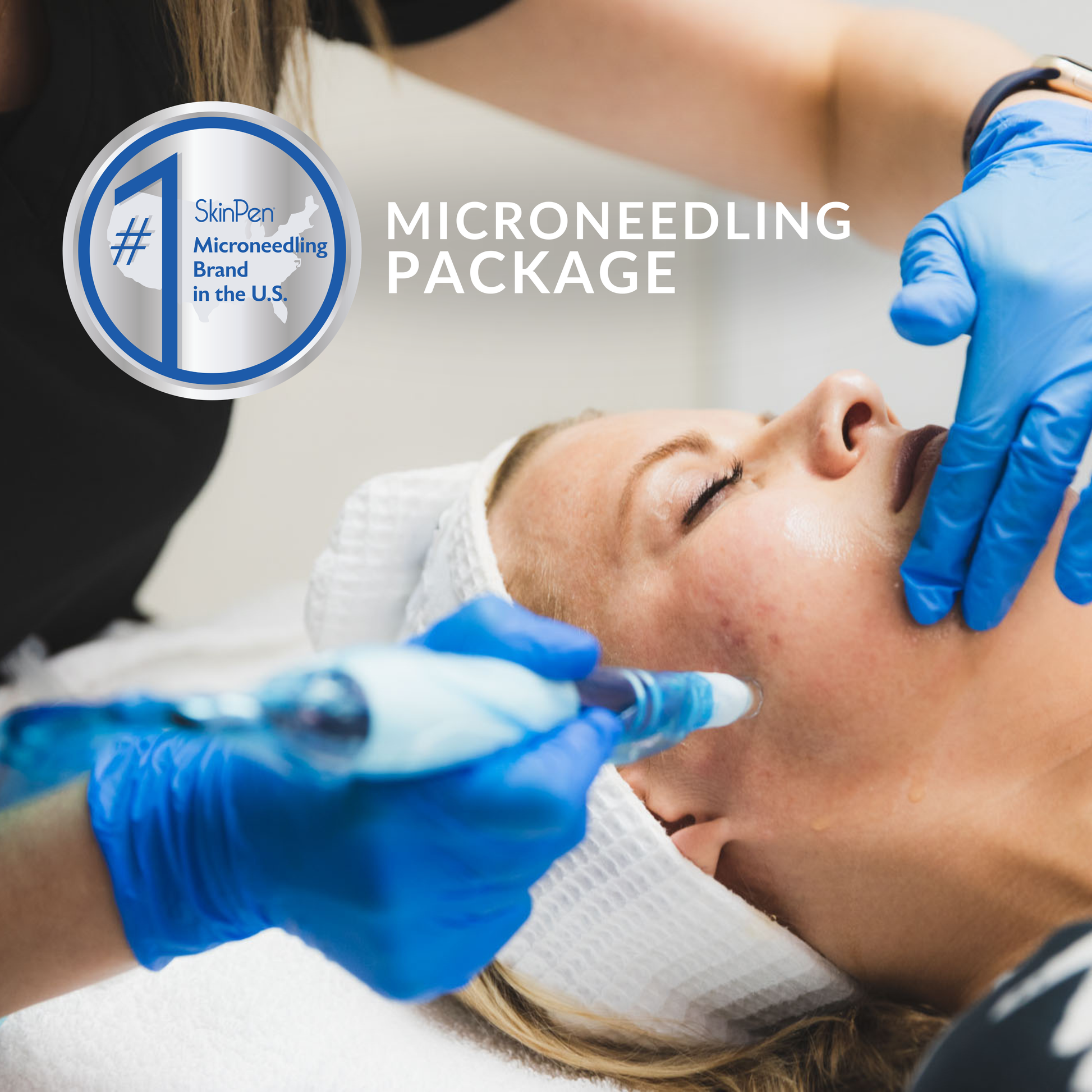 Summer Microneedling Package