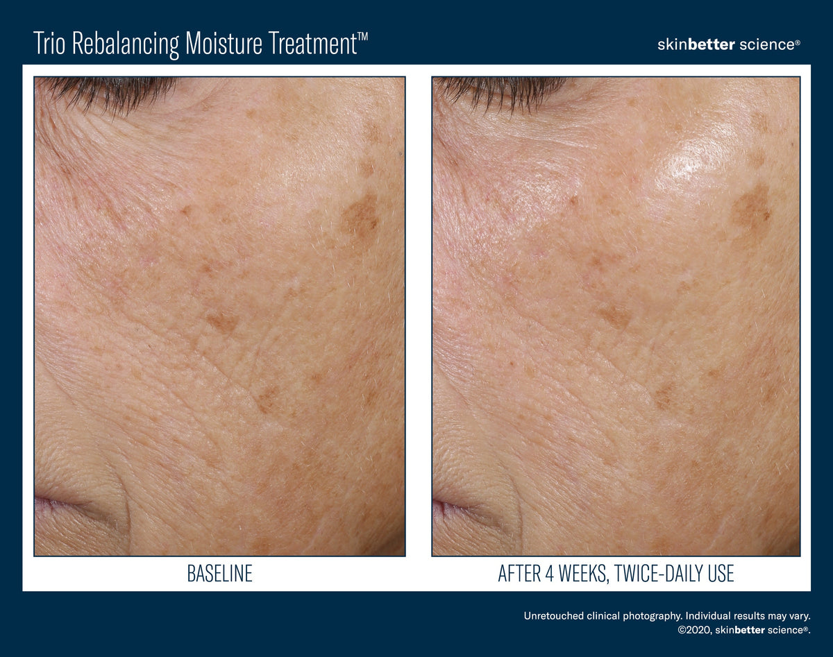 Trio Rebalancing Moisture Treatment 50 ml